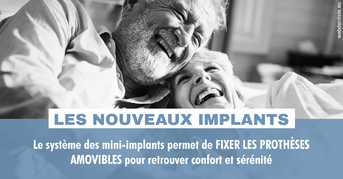 https://dr-bourlon-jean-pierre.chirurgiens-dentistes.fr/Les nouveaux implants 2