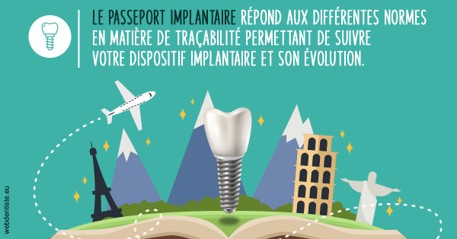 https://dr-bourlon-jean-pierre.chirurgiens-dentistes.fr/Le passeport implantaire