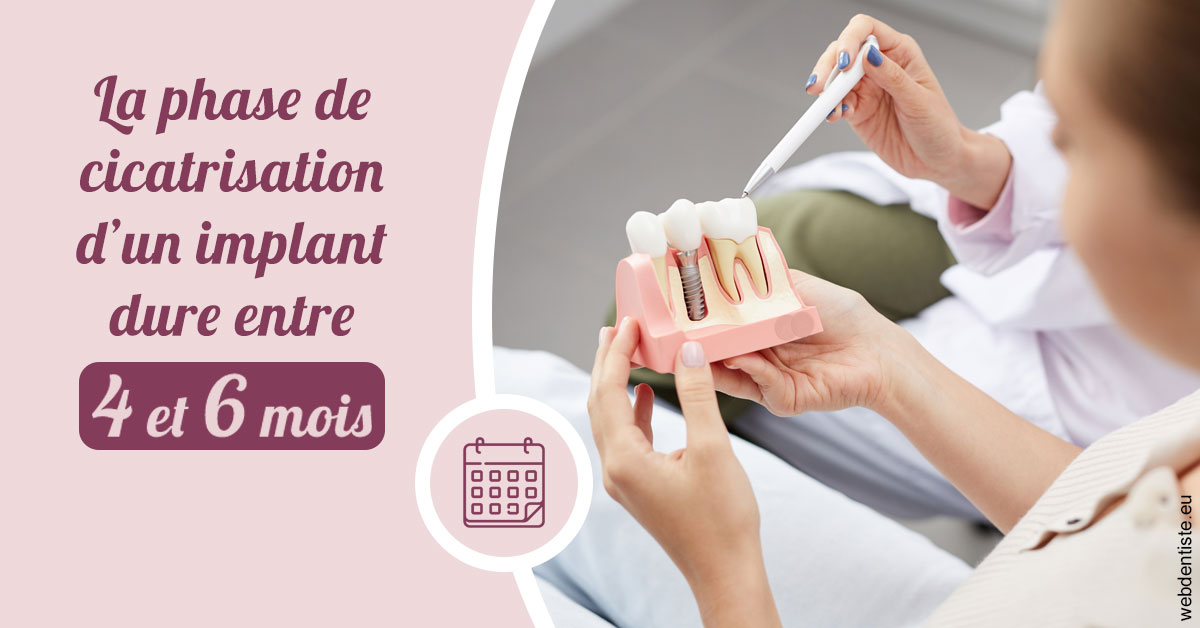 https://dr-bourlon-jean-pierre.chirurgiens-dentistes.fr/Cicatrisation implant 2