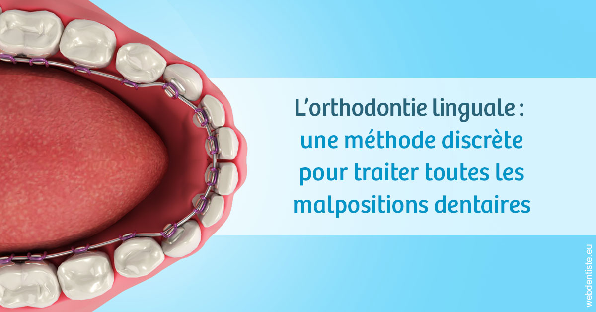 https://dr-bourlon-jean-pierre.chirurgiens-dentistes.fr/L'orthodontie linguale 1