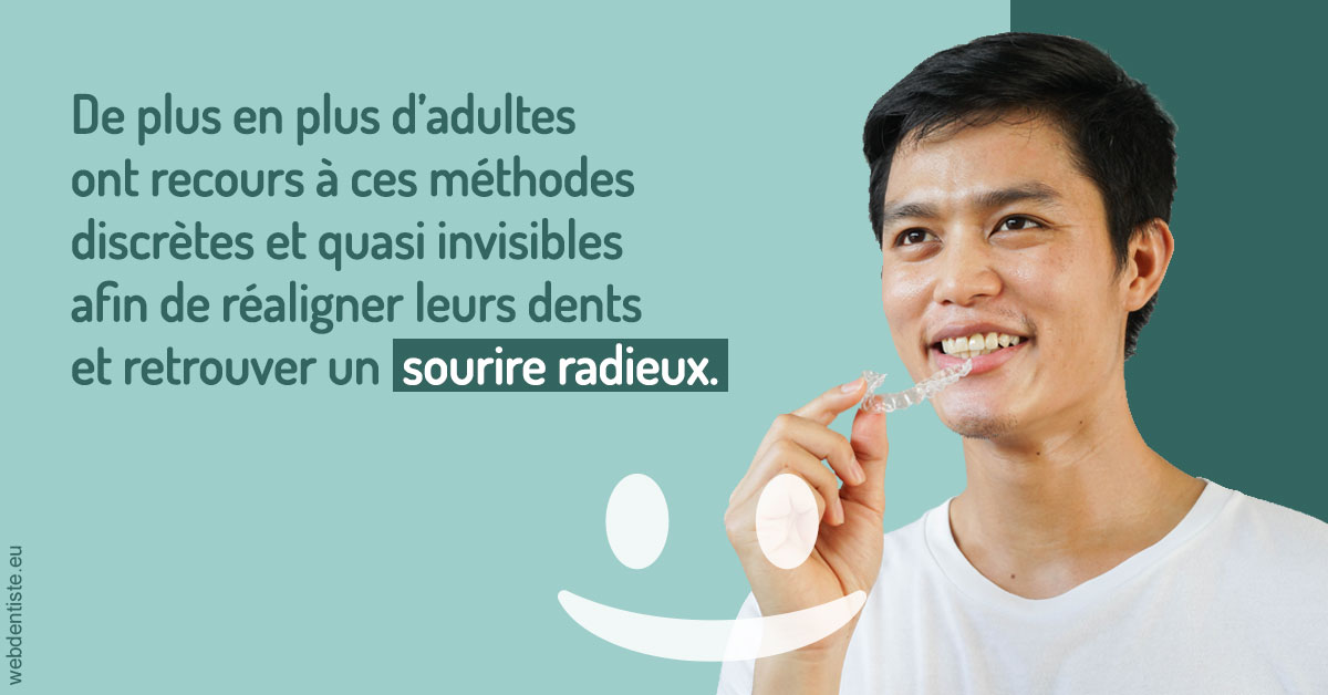 https://dr-bourlon-jean-pierre.chirurgiens-dentistes.fr/Gouttières sourire radieux 2