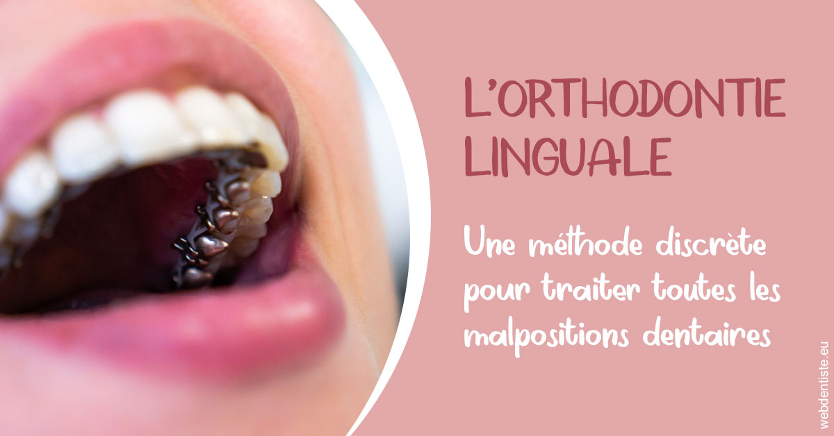 https://dr-bourlon-jean-pierre.chirurgiens-dentistes.fr/L'orthodontie linguale 2
