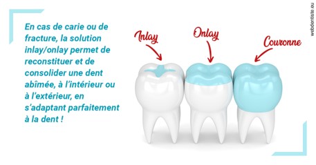 https://dr-bourlon-jean-pierre.chirurgiens-dentistes.fr/L'INLAY ou l'ONLAY
