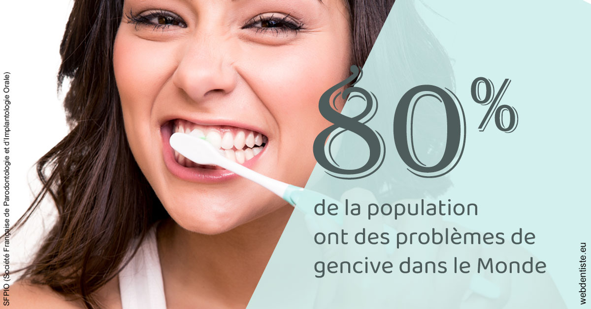 https://dr-bourlon-jean-pierre.chirurgiens-dentistes.fr/Problèmes de gencive 1
