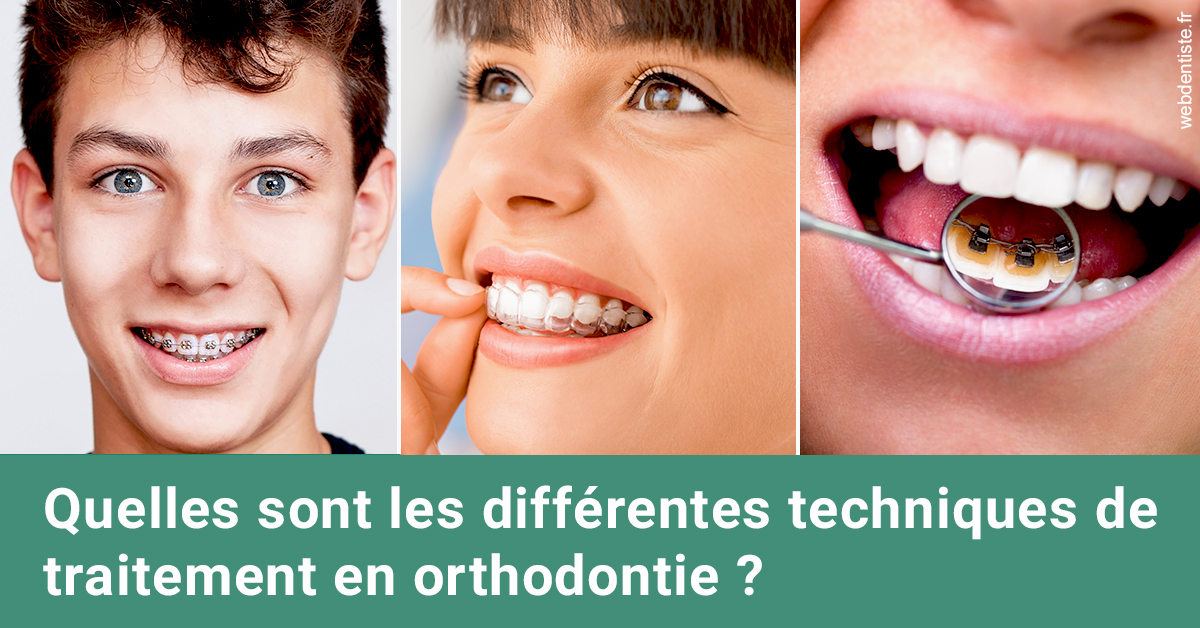 https://dr-bourlon-jean-pierre.chirurgiens-dentistes.fr/Les différentes techniques de traitement 2