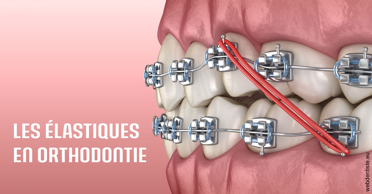 https://dr-bourlon-jean-pierre.chirurgiens-dentistes.fr/Elastiques orthodontie 2